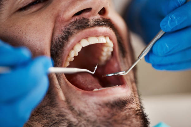 Best Dentist for Tooth Abscess  in Madison, OH